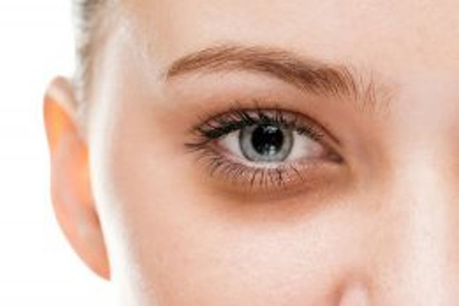 Dark Eye Circle Treatment