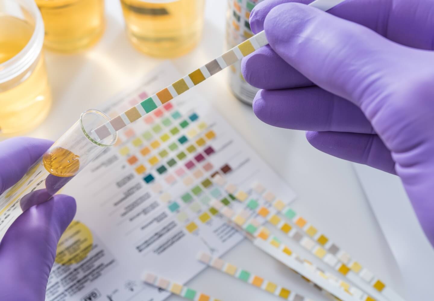 Synthetic urine kit