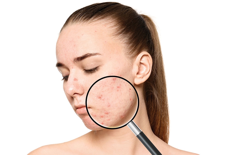 Dermatology Therapies